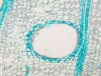 Transversal section
