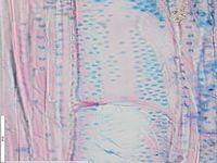 Radial section