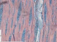 Tangential section
