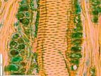 Tangential section