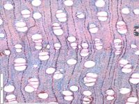Transversal section