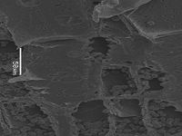 Radial section