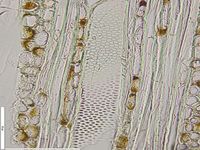 Tangential section