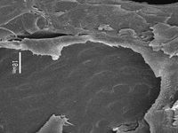 Radial section