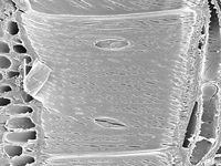Radial section