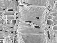 Radial section