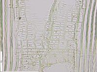 Radial section