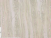 Tangential section