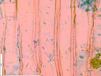 Radial section