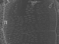 Radial section