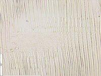 Radial section