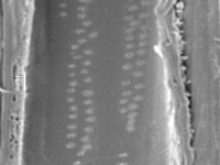 Radial section