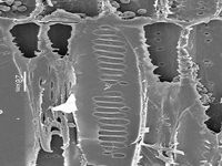 Radial section