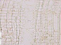 Radial section