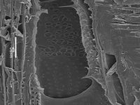 Radial section