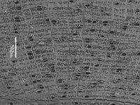 Transversal section