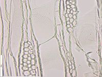 Tangential section