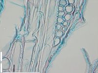 Tangential section