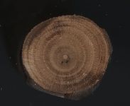 Scan transversal view