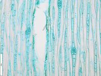 Tangential section