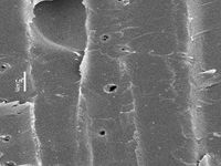 Radial section