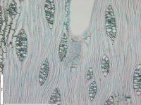 Tangential section