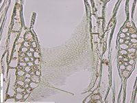 Tangential section