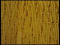 Tangential section