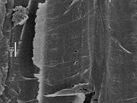 Radial section