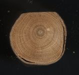 Scan transversal view