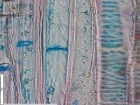 Radial section