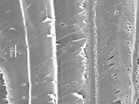 Radial section