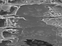 Radial section