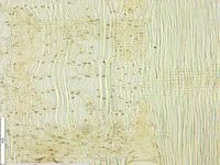 Radial section