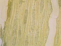 Tangential section