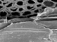 Transversal section