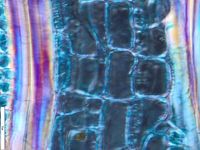 Tangential section