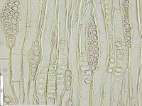 Tangential section
