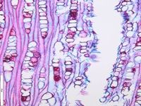 Tangential section