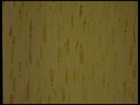 Tangential section