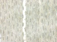 Tangential section