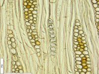 Tangential section