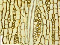 Tangential section