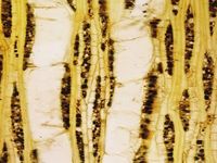 Tangential section