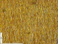 Tangential section