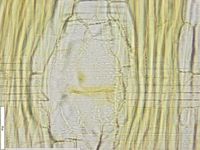 Radial section
