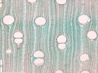 Transversal section