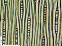 Tangential section