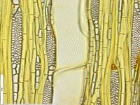 Tangential section