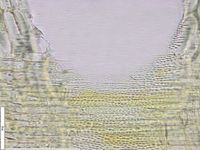 Radial section